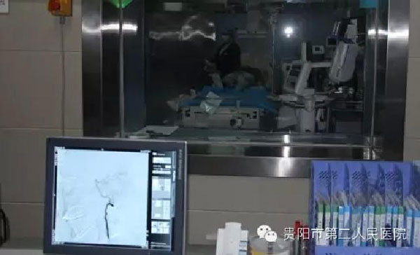 我院完成第一例支气管动脉-肺动脉瘘的介入栓塞术
