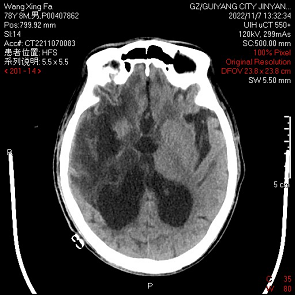 微信图片_20221111171415.png