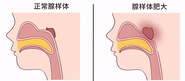 15.jpg 15.jpg