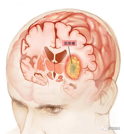 15.png 15.png