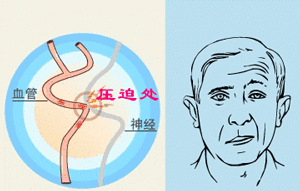 21.gif 21.gif